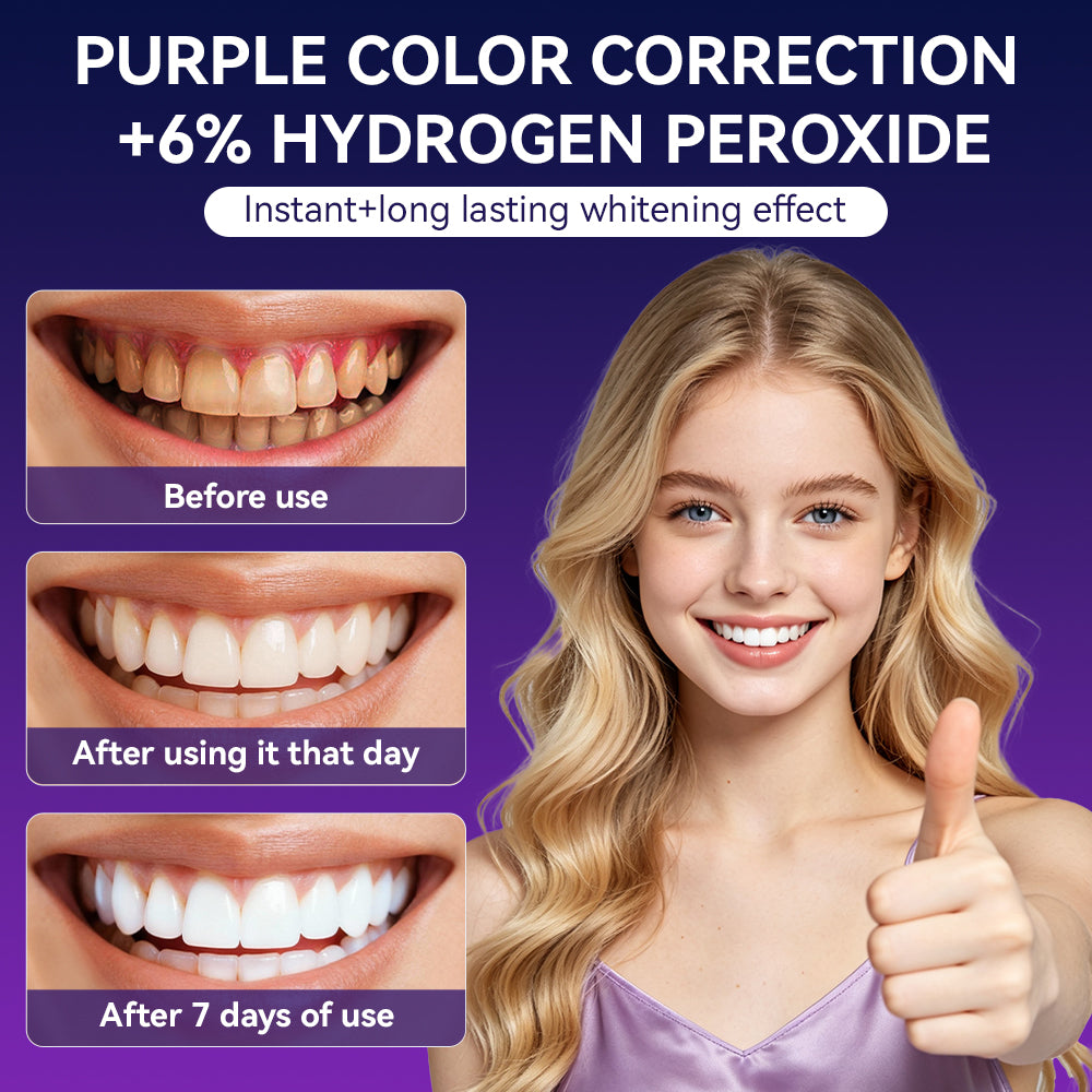 😁 Teeth Whitening Strips – 30 Pairs