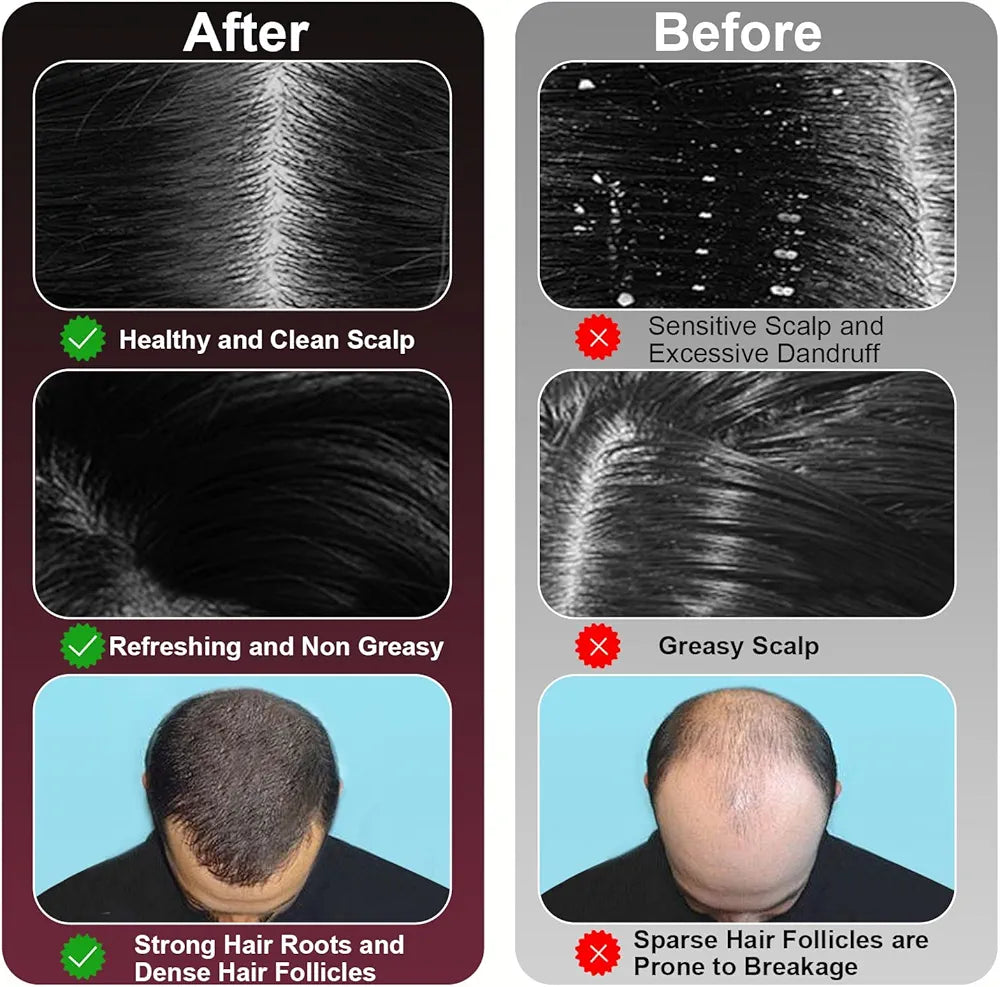 Laser Therapy Hair Growth Comb – Electric Scalp Massager & Hair Oil Applicator Waterproof